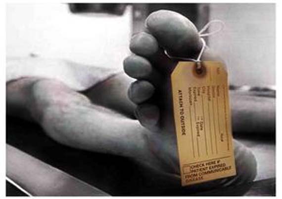 Morire entro 5 anni? Ora si pu sapere